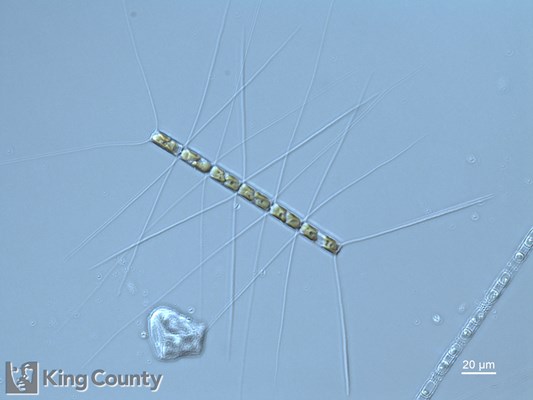 Photo of Chaetoceros similis